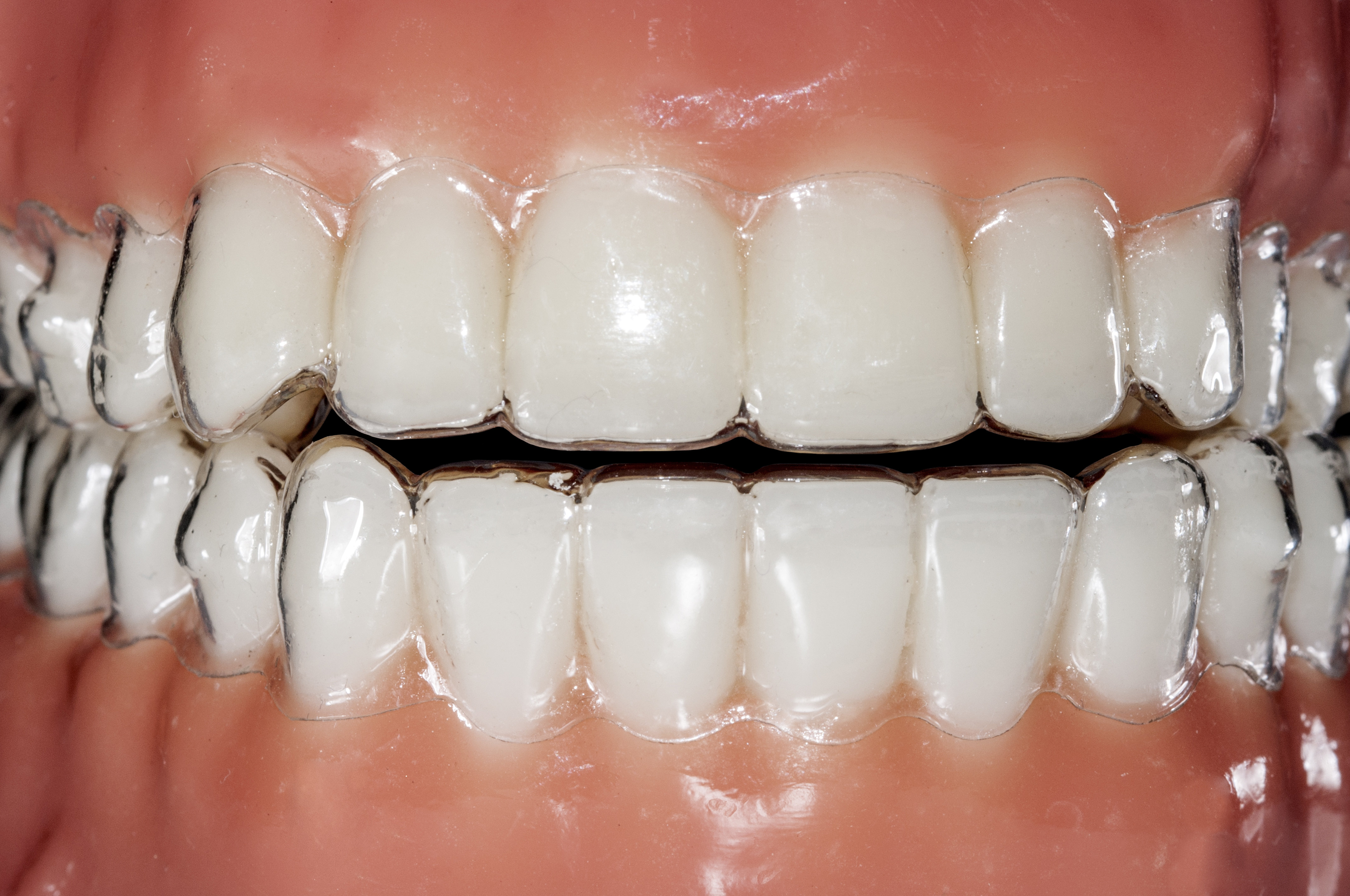 Straightening Your Smile: 3 Common Teeth Alignment Procedures
